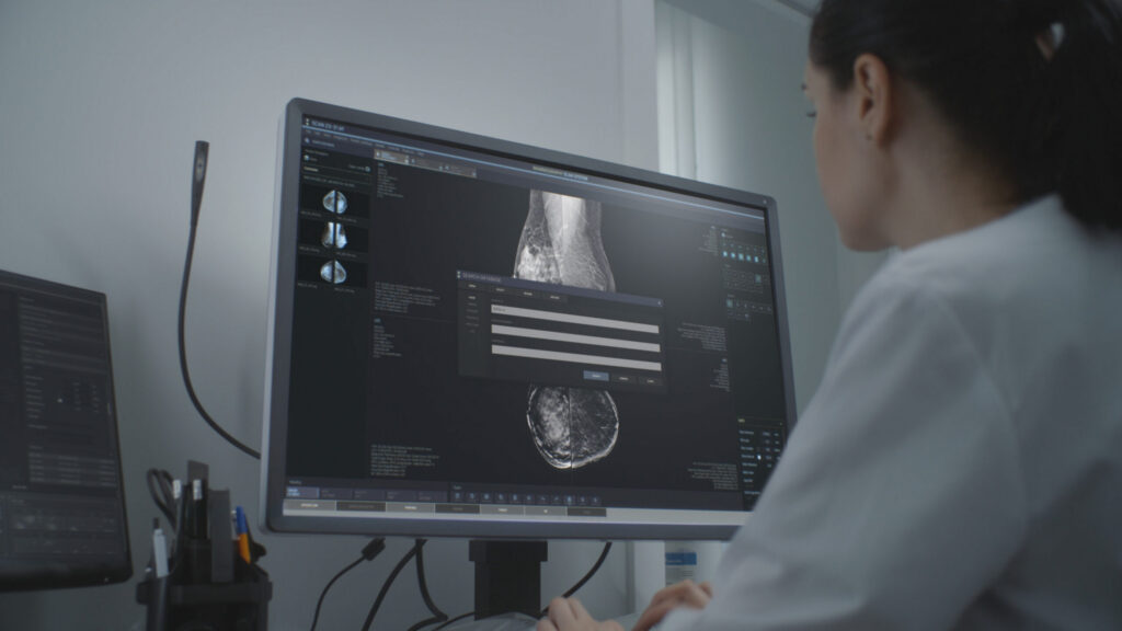 Breast cancer risk assessment improves with mammography AI and polygenic risk scores